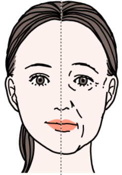 骨格、皮下組織、筋肉、皮膚の加齢による変化の図